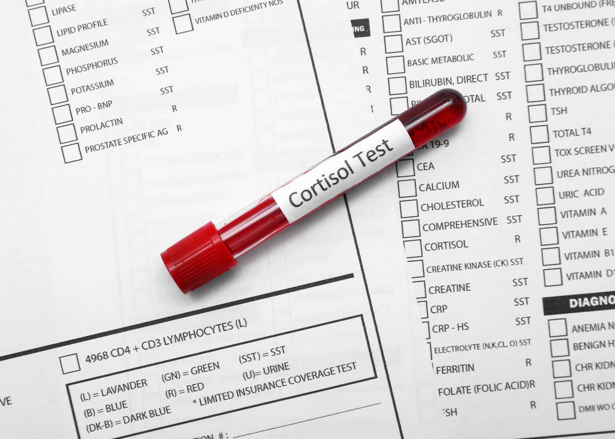 Cortisol and testosterone response graph